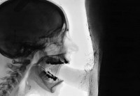 Пикантные секс фото снимки под рентгеном (рентген-анатомия)